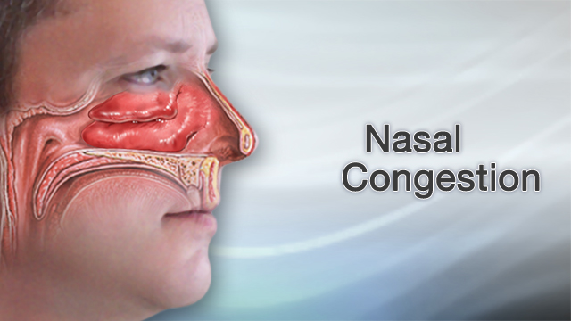 congested nose