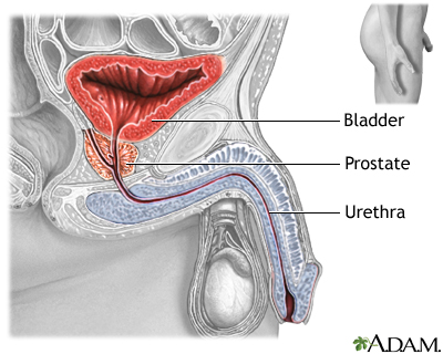 amikor a prostatitis rákba kerül)