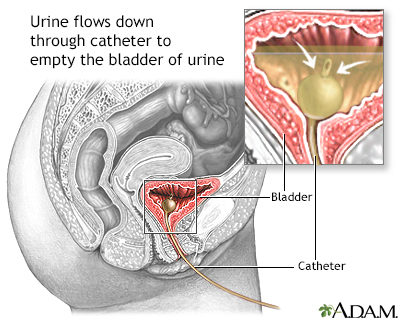 Women S Center Penn State Hershey Medical Center Urinary