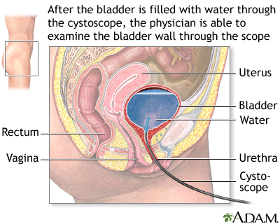 Women S Center Penn State Hershey Medical Center Urinary Incontinence Penn State Hershey Medical Center