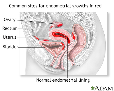 bleeding after menses over