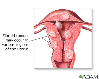 light menstrual bleeding