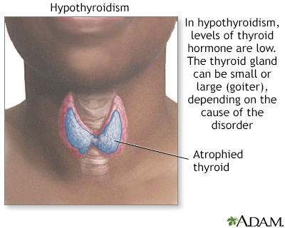 Reduce testosterone levels