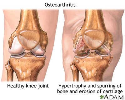 kneecap feels loose