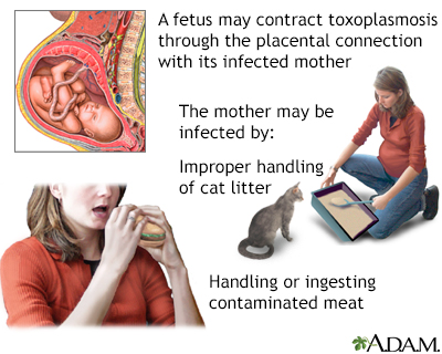 Toxoplasmosis - Penn State Hershey 