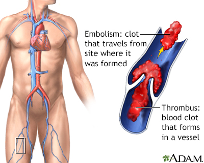 Nonsteroidal drugs anti inflammatory