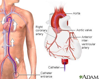arteries and veins diagram. arteries+and+veins+diagram
