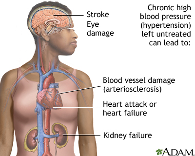 Heart Center Penn State Hershey Medical Center High Blood Pressure Penn State Hershey Medical Center