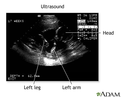 - Penn State Hershey Medical Center - Ultrasound - Penn ... diagram of fetus adam 