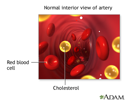 heart disease. heart disease