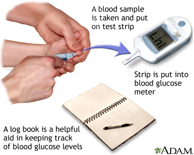 Blood Sugar Test Purpose Procedure And Results