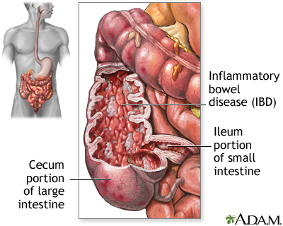 Hiatal scan for gallbladder