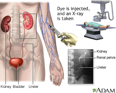 Women S Center Penn State Hershey Medical Center Kidney Stones Penn State Hershey Medical Center