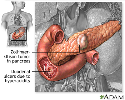 Pain ulcer tramadol for