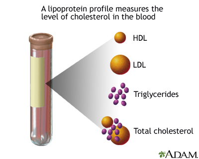 Lipid Profile Test Chart