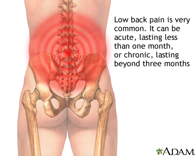 Heart attack pain in arm description