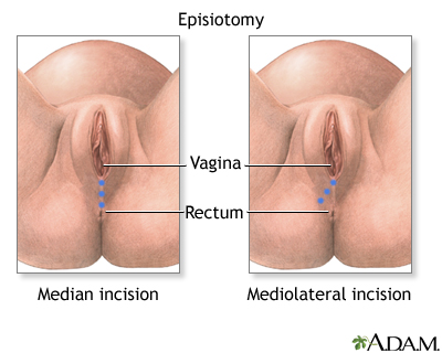 Vagina After Baby 14