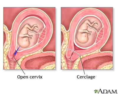 Cervix During Labor