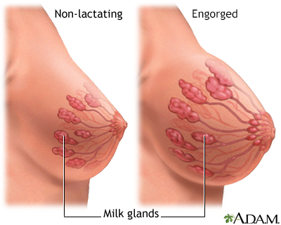 Milk In Breast Not Pregnant 47
