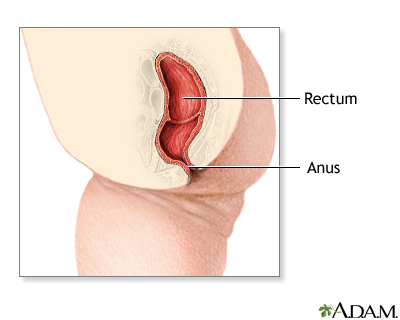 Pregnancy and imperforate anus