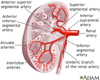 Acute Arterial Occlusion Kidney Penn State Hershey Medical Center