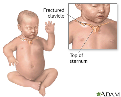 trophic feeding in neonates pdf