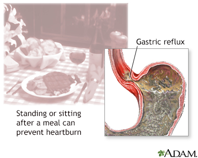 What causes a burning sensation in the lower abdomen?