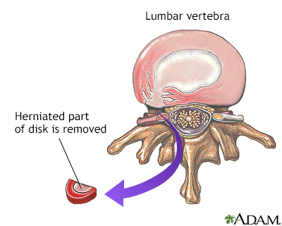 exercises for lower back pain. causes of lower back pain.